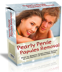 pearly penile papules removal